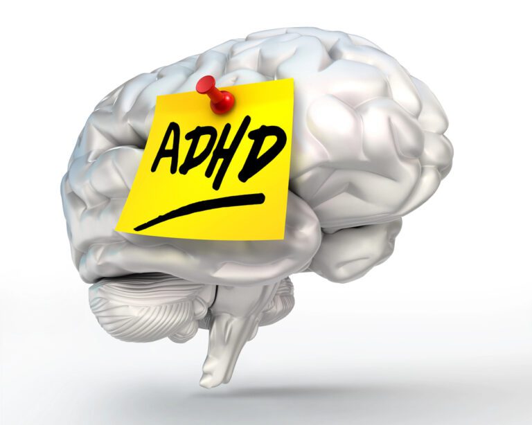 A representation of ADHD hyperfocus brain